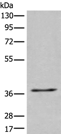 Western blot analysis of 231 cell lysate  using UBAC2 Polyclonal Antibody at dilution of 1:400