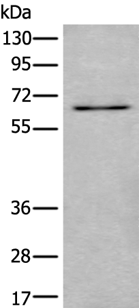 Western blot analysis of SKOV3 cell lysate  using UBQLN2 Polyclonal Antibody at dilution of 1:500