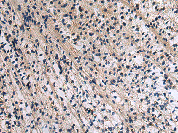 Immunohistochemistry of paraffin-embedded Human brain tissue  using CD274 Polyclonal Antibody at dilution of 1:30(×200)