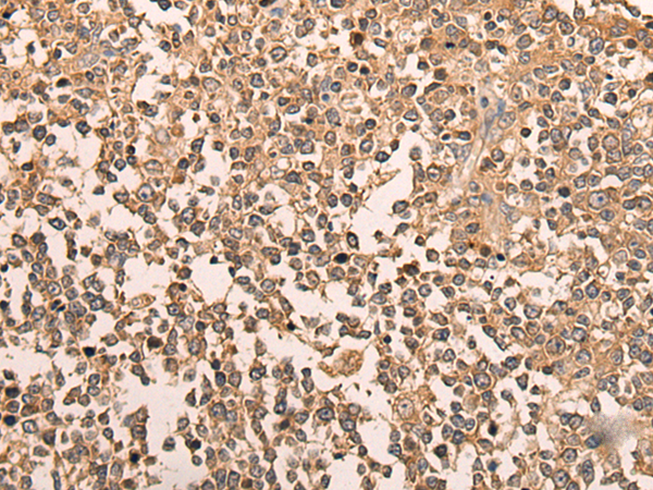 Immunohistochemistry of paraffin-embedded Human tonsil tissue  using LDAH Polyclonal Antibody at dilution of 1:70(×200)
