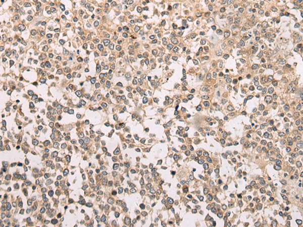 Immunohistochemistry of paraffin-embedded Human tonsil tissue  using M1AP Polyclonal Antibody at dilution of 1:80(×200)