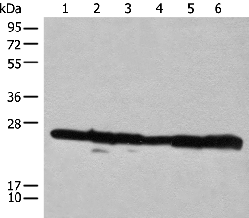 Western blot analysis of 293T cell lysates  using RPL14 Polyclonal Antibody at dilution of 1:300