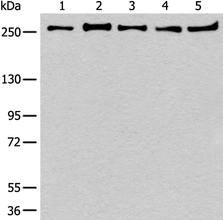Western blot analysis of 293T K562 Raji Hela and NIH/3T3 cell lysates  using PRPF8 Polyclonal Antibody at dilution of 1:600