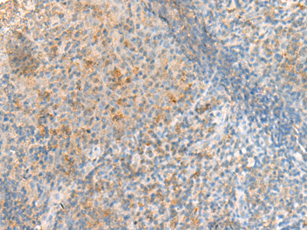 Immunohistochemistry of paraffin-embedded Human tonsil tissue  using METTL17 Polyclonal Antibody at dilution of 1:50(×200)