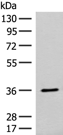 Western blot analysis of Mouse small intestines tissue lysate  using FAM84A Polyclonal Antibody at dilution of 1:300