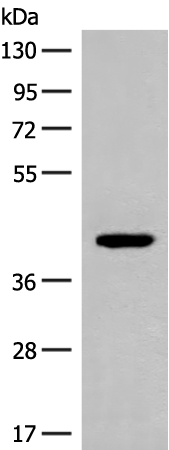 Western blot analysis of 293T cell lysate  using FCGRT Polyclonal Antibody at dilution of 1:500