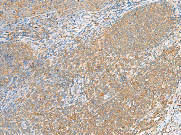 Immunohistochemistry of paraffin-embedded Human tonsil tissue  using FOLR1 Polyclonal Antibody at dilution of 1:80(×200)