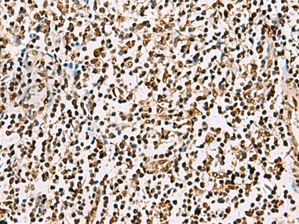 Immunohistochemistry of paraffin-embedded Human tonsil tissue  using FOXI1 Polyclonal Antibody at dilution of 1:55(×200)