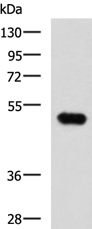 Western blot analysis of Mouse kidney tissue lysate  using FOXQ1 Polyclonal Antibody at dilution of 1:750
