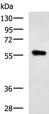 Western blot analysis of Raji cell lysate  using SQSTM1 Polyclonal Antibody at dilution of 1:900
