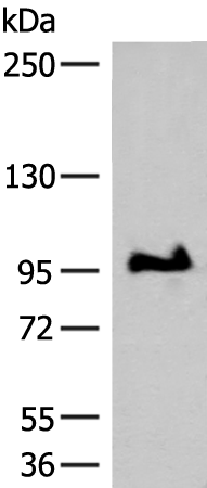 Western blot analysis of TM4 cell lysate  using GANC Polyclonal Antibody at dilution of 1:550