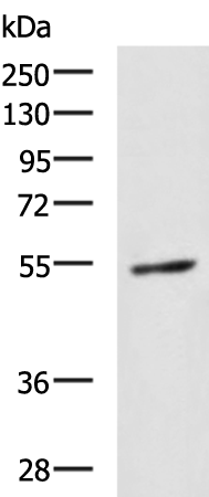 Western blot analysis of 231 cell lysate  using GBA Polyclonal Antibody at dilution of 1:1350