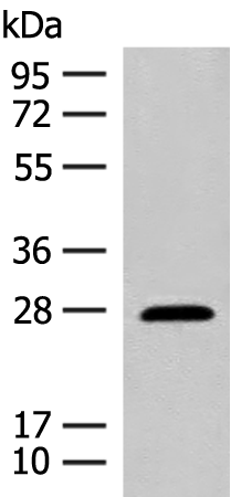 Western blot analysis of Mouse eye tissue lysate  using GUCA1B Polyclonal Antibody at dilution of 1:500