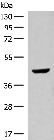 Western blot analysis of Human fetal liver tissue lysate  using GNAT1 Polyclonal Antibody at dilution of 1:250
