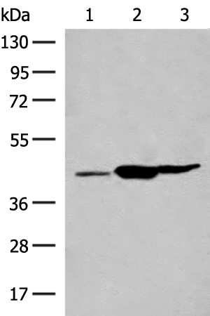 Western blot analysis of Mouse liver tissue Mouse kidney tissue Rat brain tissue lysates  using GPR22 Polyclonal Antibody at dilution of 1:500