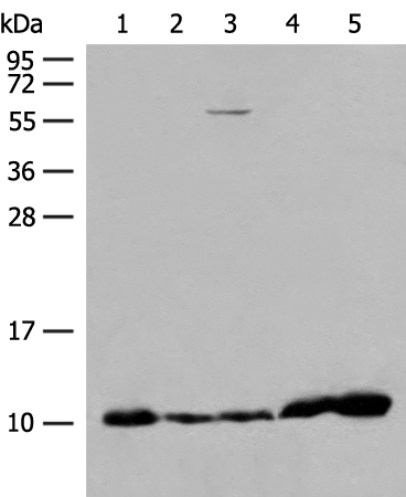 Western blot analysis of 293T cell Human fetal liver tissue Human heart tissue lysates  using ATP5I Polyclonal Antibody at dilution of 1:200