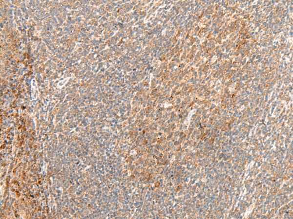 Immunohistochemistry of paraffin-embedded Human tonsil tissue  using GPR62 Polyclonal Antibody at dilution of 1:40(×200)