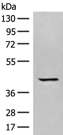 Western blot analysis of A549 cell lysate  using GPR62 Polyclonal Antibody at dilution of 1:350