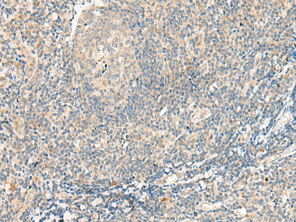 Immunohistochemistry of paraffin-embedded Human tonsil tissue  using GPR75 Polyclonal Antibody at dilution of 1:95(×200)