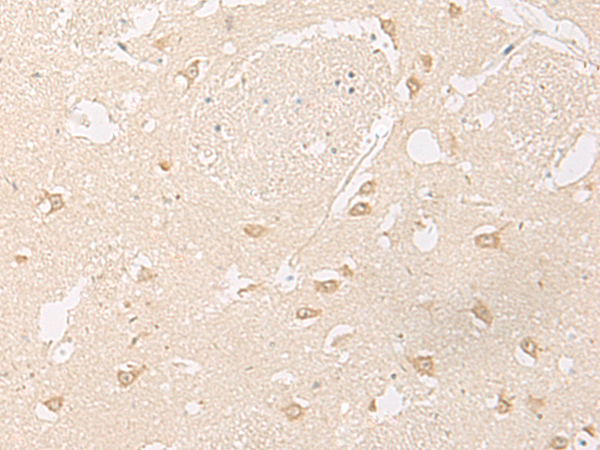 Immunohistochemistry of paraffin-embedded Human brain tissue  using GPR157 Polyclonal Antibody at dilution of 1:60(×200)