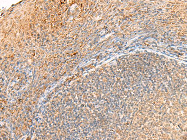 Immunohistochemistry of paraffin-embedded Human tonsil tissue  using GPR161 Polyclonal Antibody at dilution of 1:40(×200)