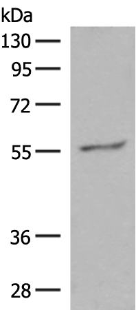 Western blot analysis of Hela cell lysate  using GPR161 Polyclonal Antibody at dilution of 1:500