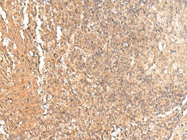 Immunohistochemistry of paraffin-embedded Human tonsil tissue  using GTF3A Polyclonal Antibody at dilution of 1:60(×200)