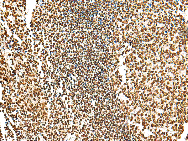 Immunohistochemistry of paraffin-embedded Human tonsil tissue  using HABP4 Polyclonal Antibody at dilution of 1:55(×200)