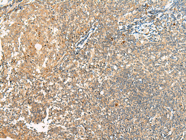 Immunohistochemistry of paraffin-embedded Human tonsil tissue  using HEBP1 Polyclonal Antibody at dilution of 1:40(×200)