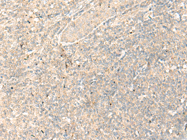 Immunohistochemistry of paraffin-embedded Human tonsil tissue  using RGR Polyclonal Antibody at dilution of 1:25(×200)