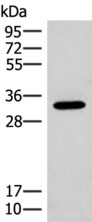 Western blot analysis of Mouse liver tissue lysate  using RGR Polyclonal Antibody at dilution of 1:300