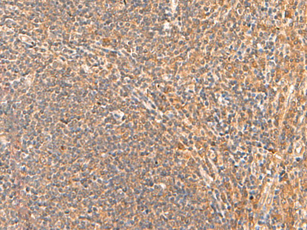 Immunohistochemistry of paraffin-embedded Human tonsil tissue  using HPCA Polyclonal Antibody at dilution of 1:55(×200)