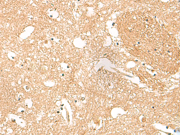 Immunohistochemistry of paraffin-embedded Human brain tissue  using HPCA Polyclonal Antibody at dilution of 1:55(×200)