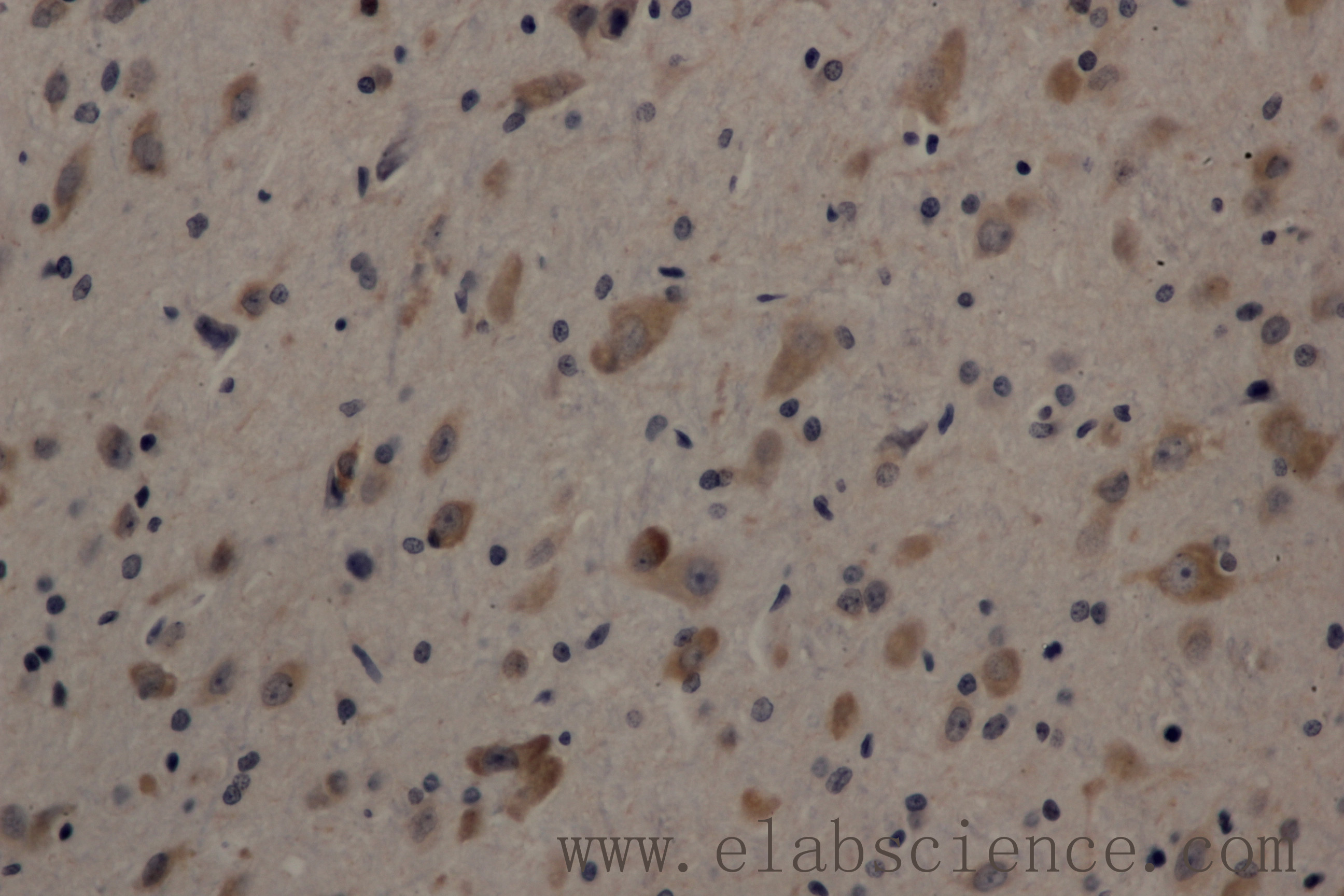 Immunohistochemistry of paraffin-embedded Rat brain using Cleaved-NOTCH1 (V1754) Polyclonal Antibody at dilution of 1:200