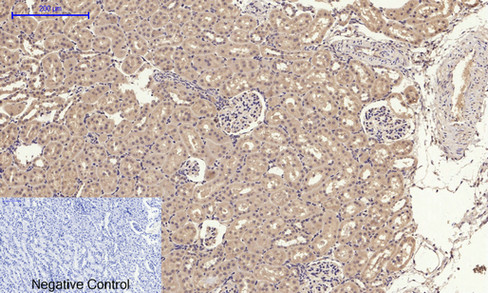 Immunohistochemistry of paraffin-embedded Rat kidney tissue using GLUT-4 Polyclonal Antibody at dilution of 1:200.