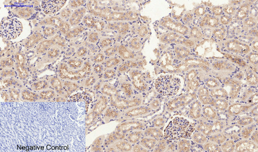 Immunohistochemistry of paraffin-embedded Rat kidney tissue using JAK2 Polyclonal Antibody at dilution of 1:200.