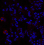 Immunofluorescence analysis of Rat lung tissue using TGFB1 Polyclonal Antibody at dilution of 1:200.