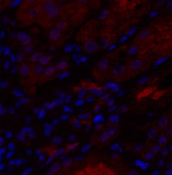 Immunofluorescence analysis of Human kidney tissue using IL8 Polyclonal Antibody at dilution of 1:200.