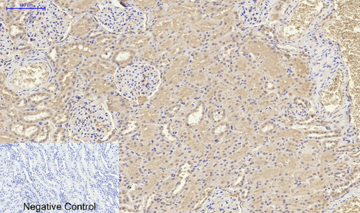 Immunohistochemistry of paraffin-embedded Human kidney tissue using IL8 Polyclonal Antibody at dilution of 1:200.