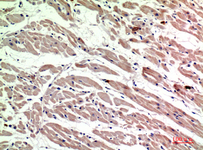 Immunohistochemistry of paraffin-embedded Human heart tissue using CD206 Polyclonal Antibody at dilution of 1:200.