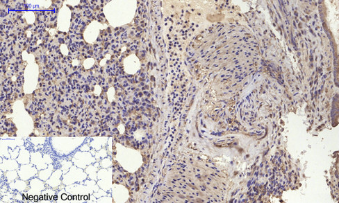 Immunohistochemistry of paraffin-embedded Rat lung tissue using BMP2 Polyclonal Antibody at dilution of 1:200.