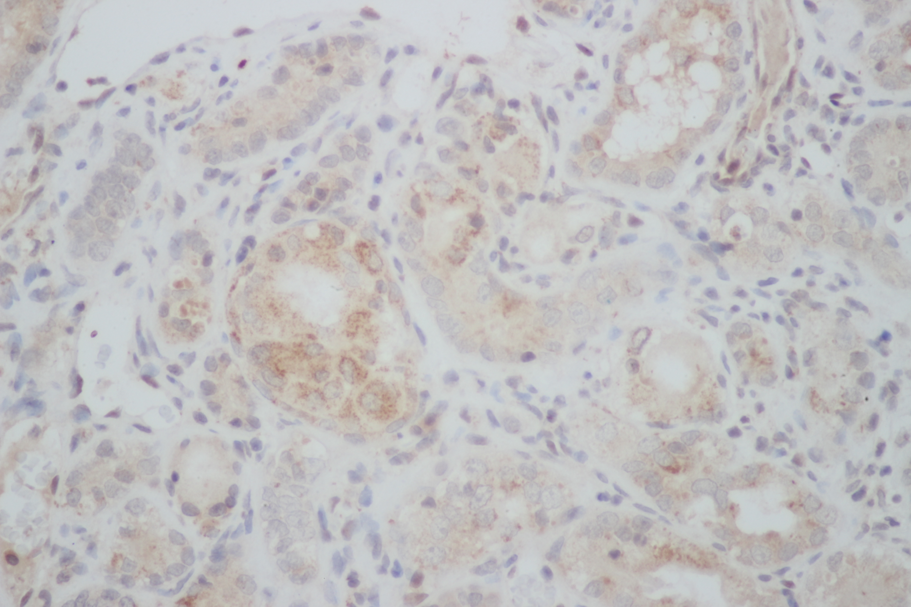 Immunohistochemistry of paraffin-embedded Rat kidney using ERG Polyclonal Antibody at dilution of 1:50