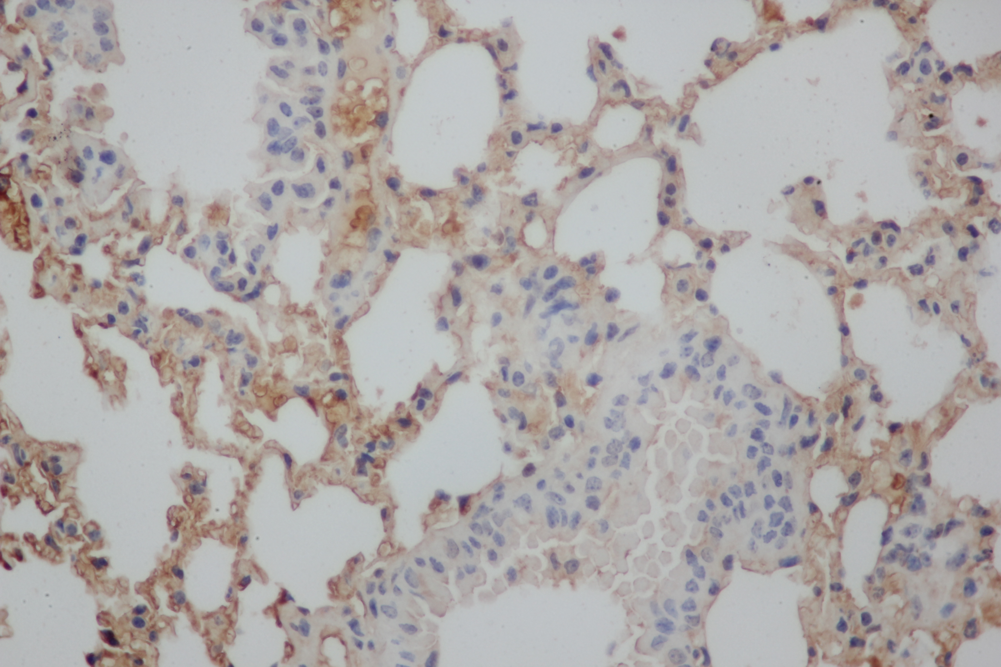 Immunohistochemistry of paraffin-embedded Rat lung using Aβ40 Polyclonal Antibody at dilution of 1:50