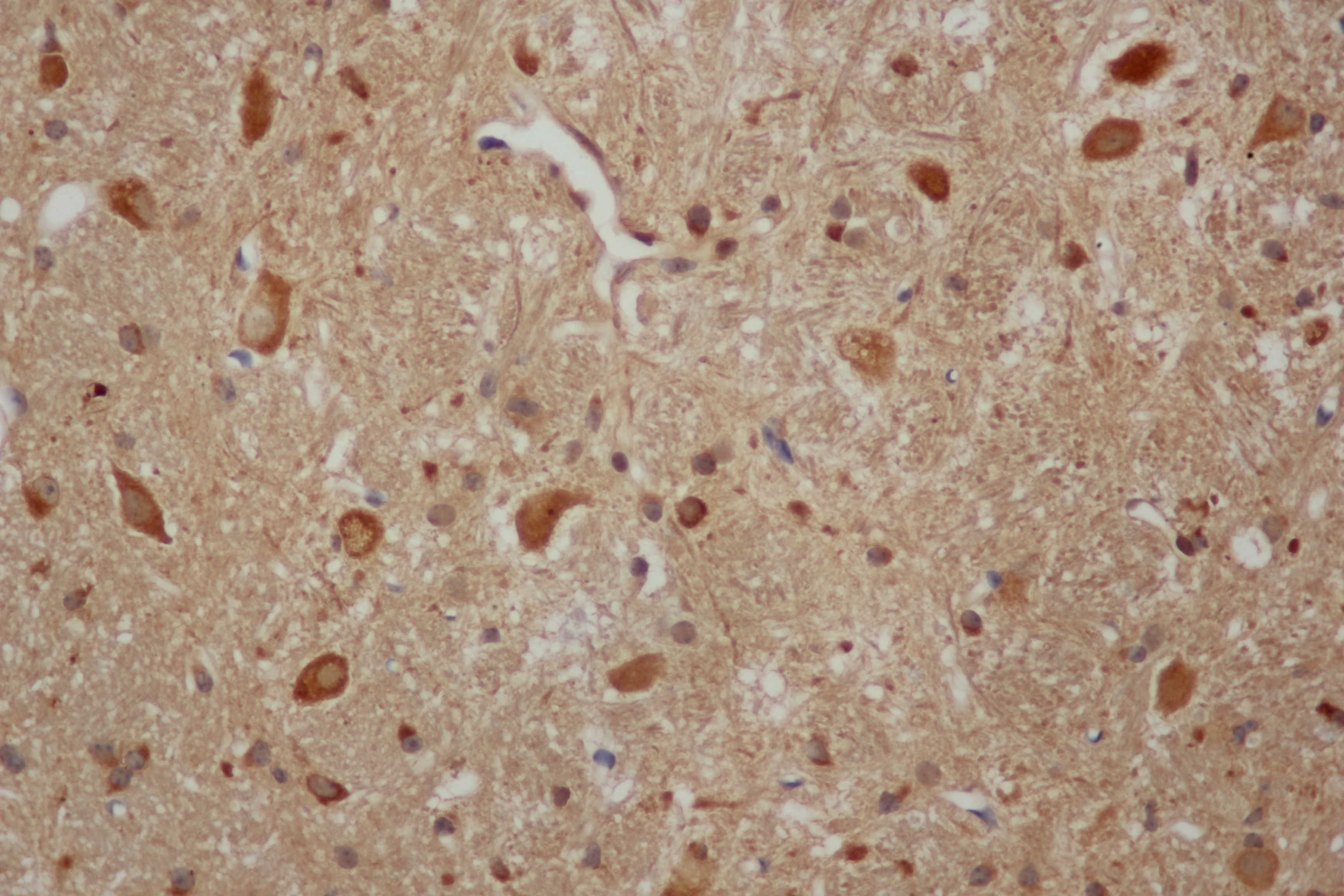 Immunohistochemistry of paraffin-embedded Mouse brain using Aβ40 Polyclonal Antibody at dilution of 1:50