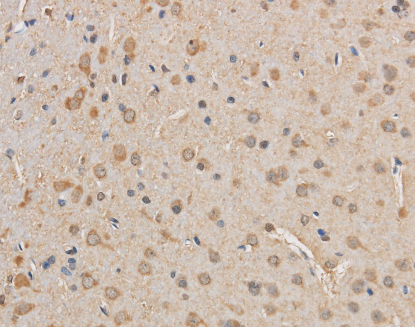 Immunohistochemistry of paraffin-embedded Rat brain using VDAC1 Polyclonal Antibody at dilution of 1:50