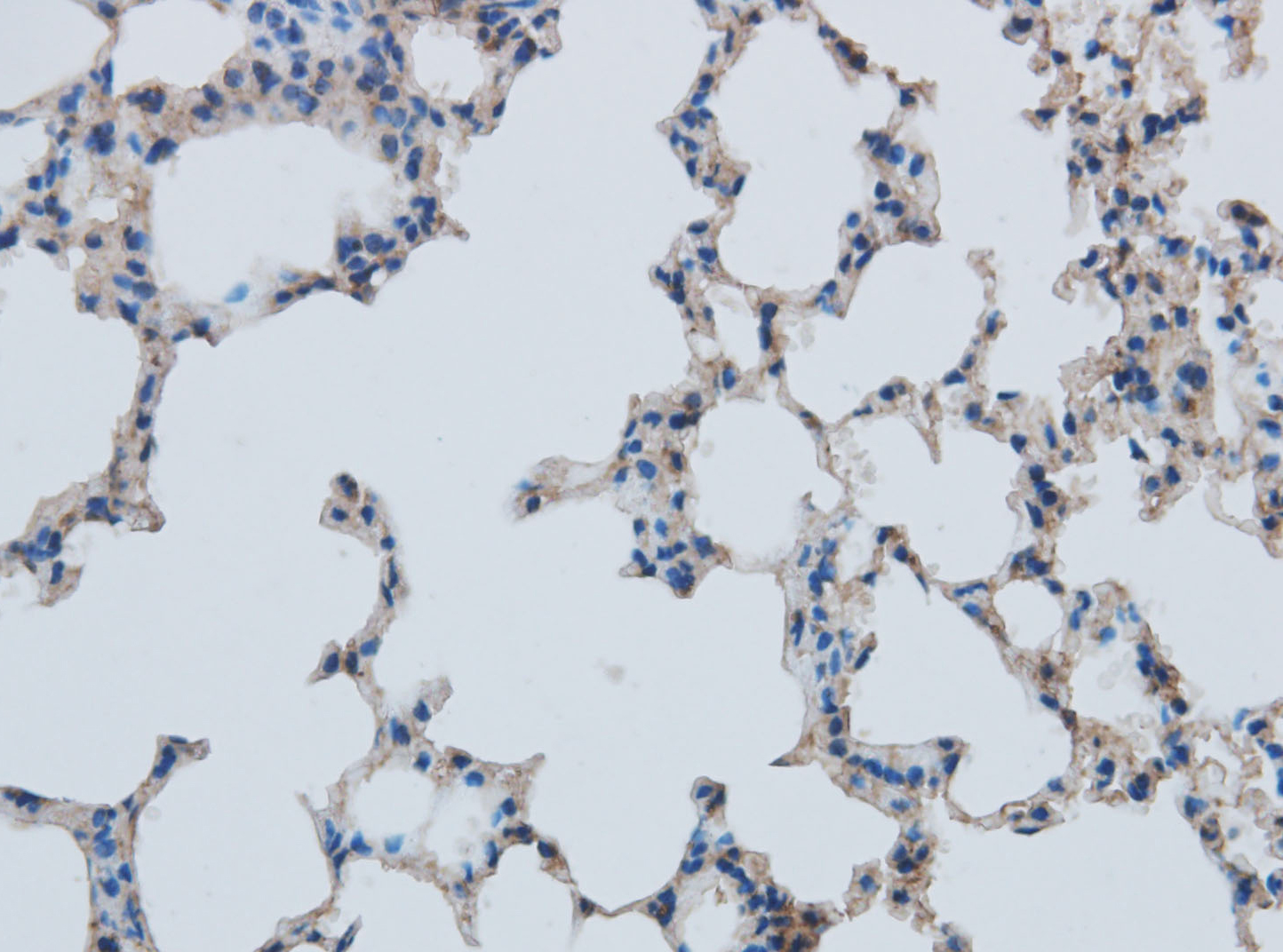Immunohistochemistry of paraffin-embedded Mouse lung using MMP1 Polyclonal Antibody at dilution of 1:50