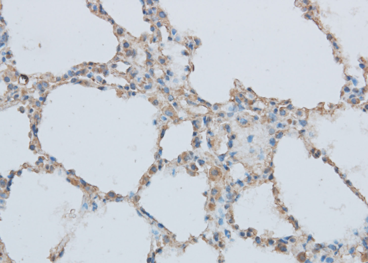 Immunohistochemistry of paraffin-embedded Rat lung using MMP1 Polyclonal Antibody at dilution of 1:50