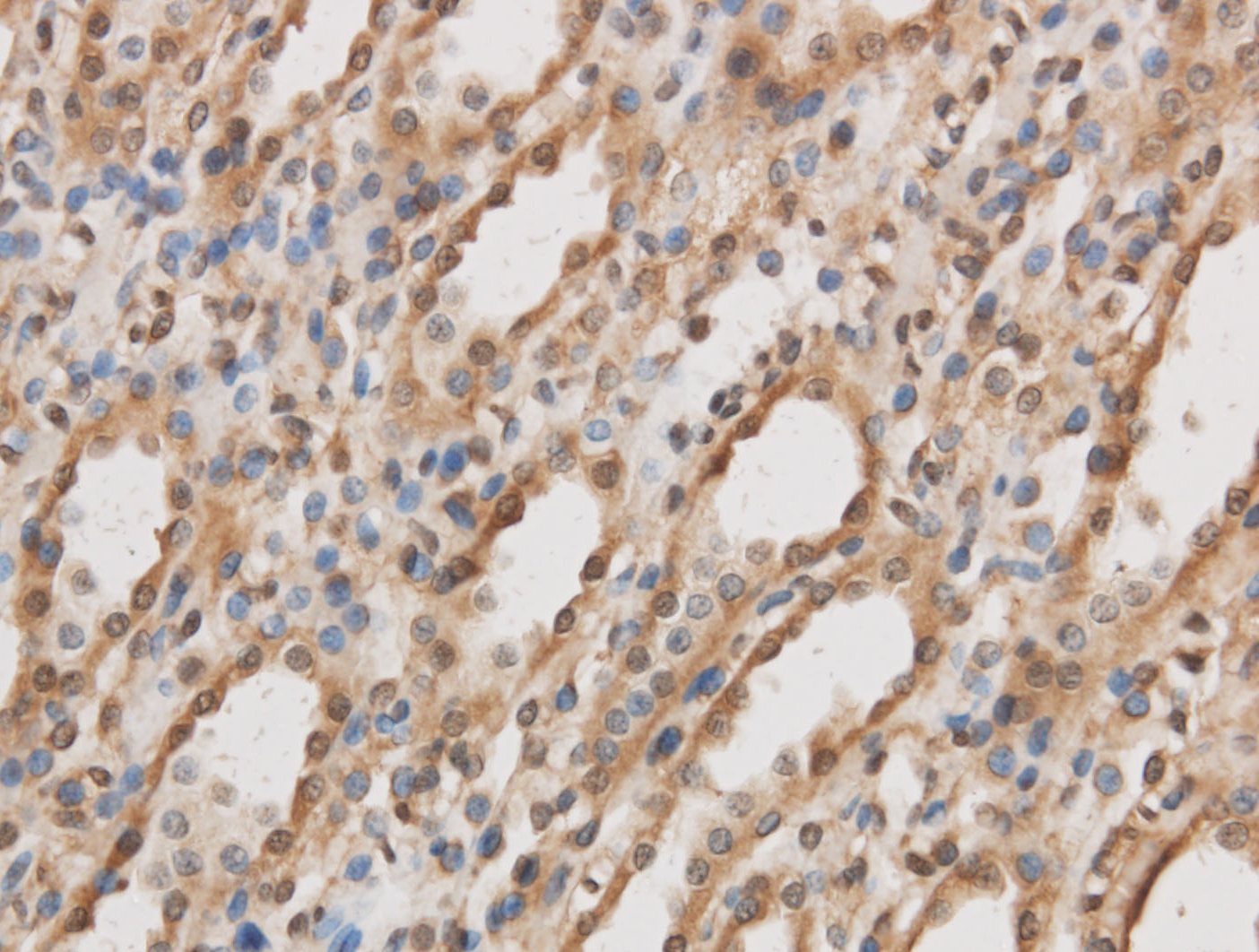 Immunohistochemistry of paraffin-embedded Rat kidney using IL10RB Polyclonal Antibody at dilution of 1:50