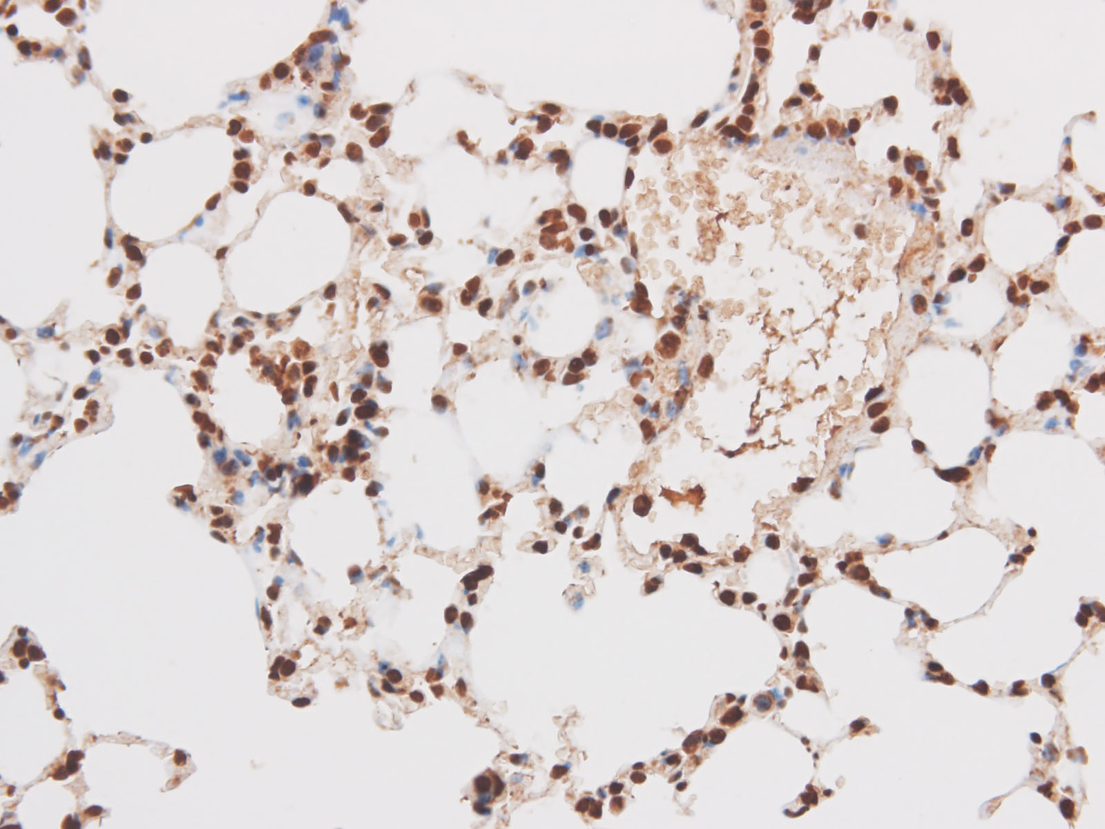 Immunohistochemistry of paraffin-embedded Rat lung using STK4 Polyclonal Antibody at dilution of 1:50