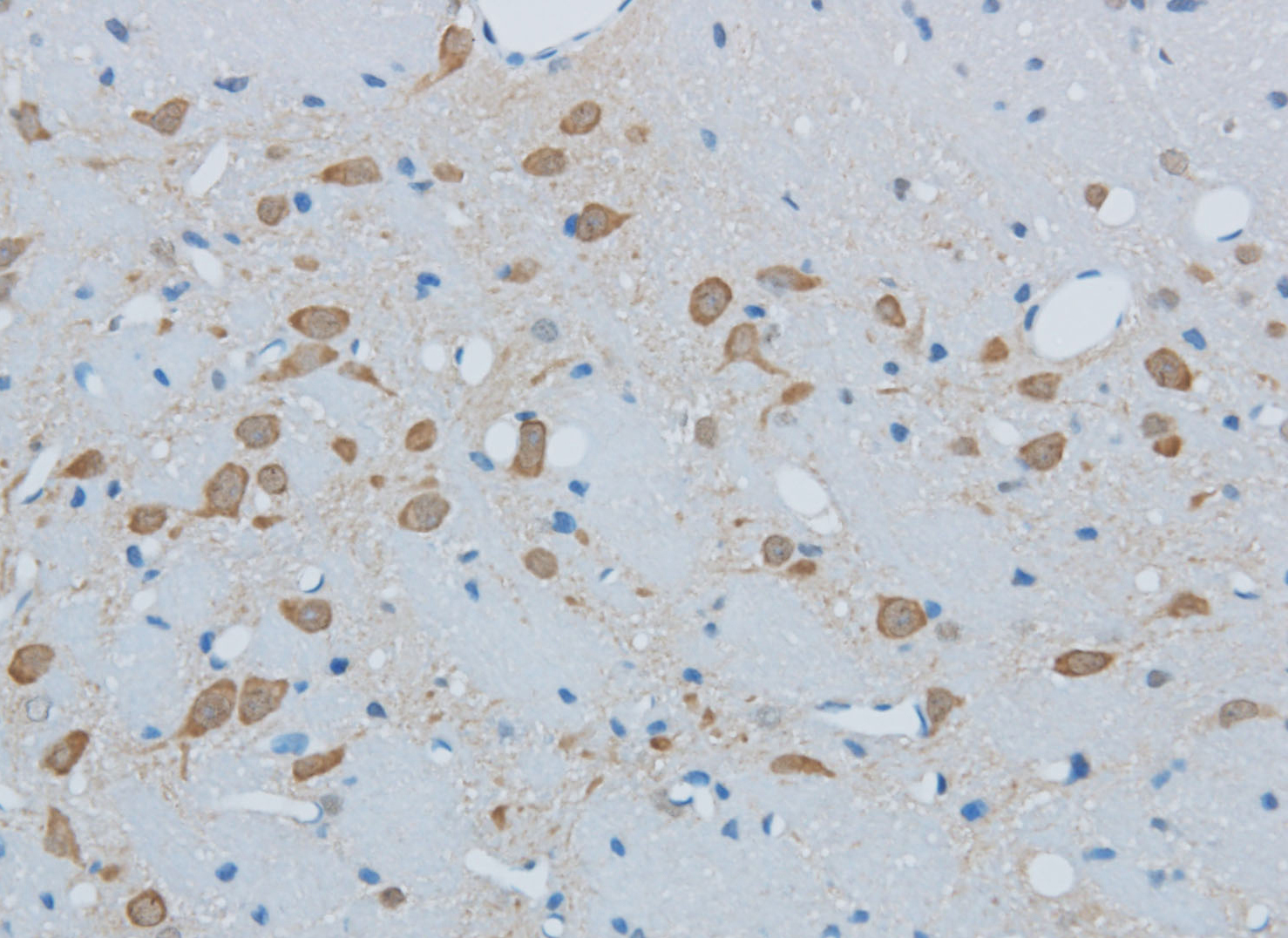 Immunohistochemistry of paraffin-embedded Mouse brain using TIMP4 Polyclonal Antibody at dilution of 1:50
